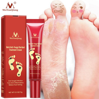 Herbal Effective Foot Treatment Anti Fungal Infection Onychomycosis Paronychia Toe Fungus Treatment Feet Repair Cream Foot Care
