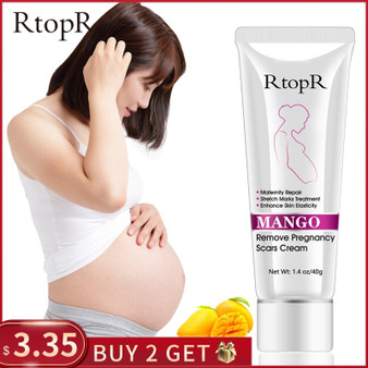 Mango Remove Pregnancy Scars Acne Cream Stretch Marks Treatment Maternity Repair Anti-Aging Anti-Winkles Firming Body Creams