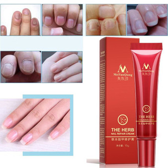 Chinese Fungal Nail Treatment Essence and Foot Whitening Toe Fungus Removal Gel Anti Infection