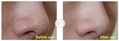 Blackhead Out Night Serum