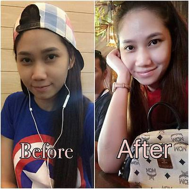 Yindara Bumebime Whitening Soap™