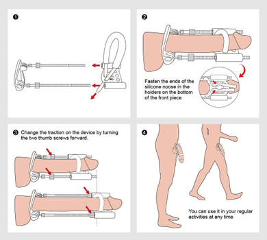 Penis Extender