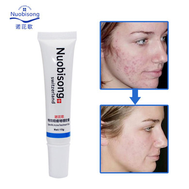 Nuobisong face skin care treatment the face Pimples scar Stretch Marks removal acne treatment whitening moisturizing cream Nuobisong face skin care treatment the face Pimples scar Stretch Marks removal acne treatment whitening moisturizing cream