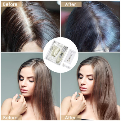 RAISE THE VOLUME - HAIR RESTORING LASER