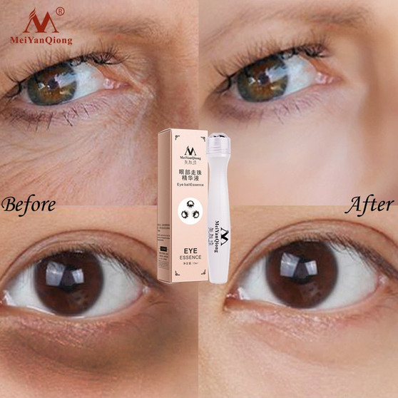 Anti Winkles Whitening Eye Cream Anti-Aging Moisturizing Skin Care Remove Eye Bags Dark Circles Puffiness Lighten Fine Lines