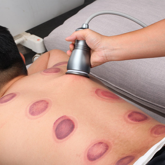 Electric Scraping Machine Body Cupping Massage Gua Sha Ventosas Anti Cellulite Fat Burner Vacuum Suction Pumps Therapy Apparatus