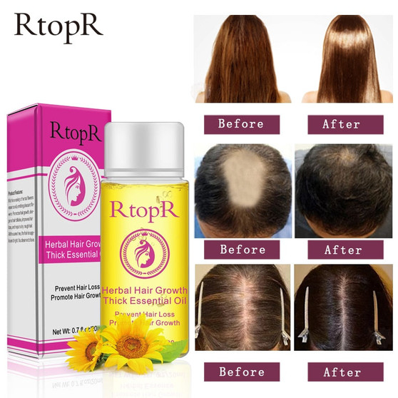 Herbal Hair Growth Anti Hair Loss Liquid Promote Thick Fast Hair Growth Treatment 20ml Essential Oil Health Care Beauty Essence