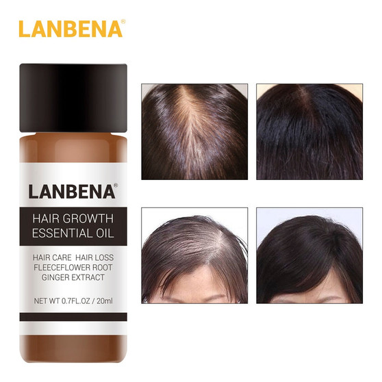LANBENA Fast Powerful Hair Growth Essence Products Essential Oil Liquid Treatment Preventing Hair Loss Hair Care Andrea 20ml