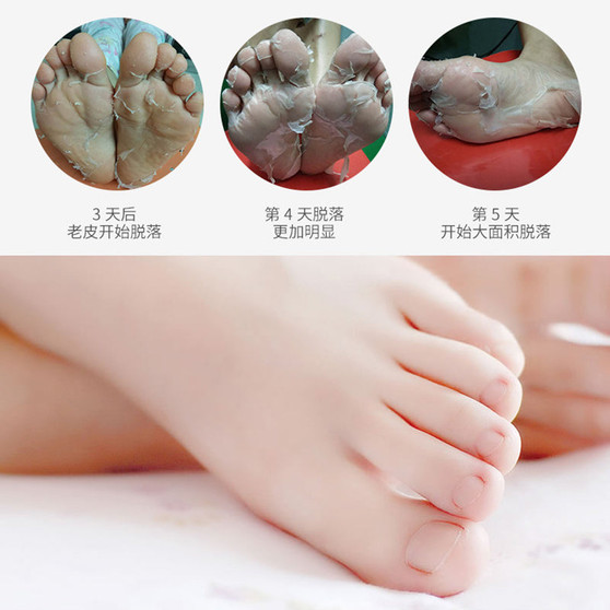 Magic Feet Exfoliating Foot Mask Skin Peeling Dead Skin Feet Mask Socks Socks For Pedicure Socks Cream