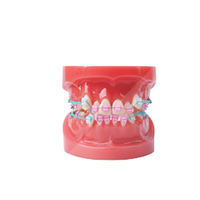 Ortho Ceramic Bracket Dental Orthodontic Model with Metal and Ceramic Brackets  Study model