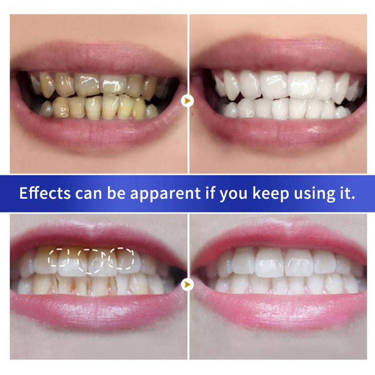 BREYLEE Teeth Whitening Powder Toothpaste Dental Teeth Cleaning Oral Hygiene Remove Plaque Tooth Whiten Brighten Powder TSLM1 (01)
