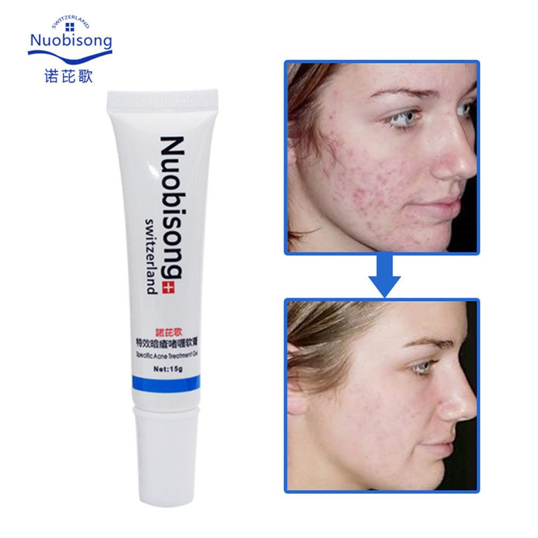 Nuobisong face skin care treatment the face Pimples scar Stretch Marks removal acne treatment whitening moisturizing cream