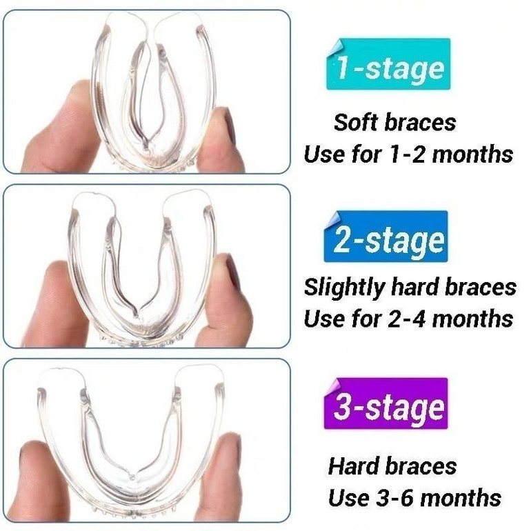 Adult Orthodontic Appliance