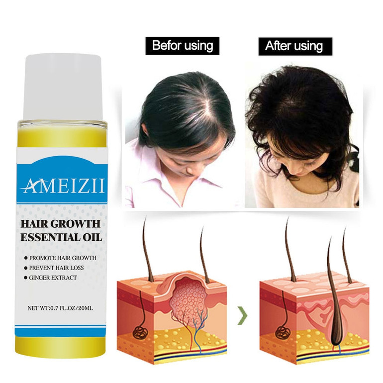 Hair Growth Essence Hair Loss Liquid Ginger Extract Hair Tonic Fast Sunburst Hair Growth Essence Original Authentic 100% TSLM2
