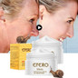 "EFERO" Snail Anti Aging & Acne Treatment & Anti Wrinkle & Skin Whitening Snail Cream
