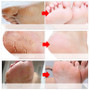 7 Pair Remove Cuticles Dead Skin Peeling Foot Masks for Pedicure