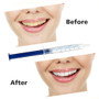 Professional Teeth Whitening Oral Gel Polish Pen Kits