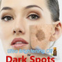 Ultra Brightening Spotless Oil Skin Care Dark Spots Remove Ance Burn Strentch Marks Scar Removal lavender Essence