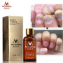 Fungal Nail Treatment Essence Nail and Foot Whitening Toe Nail Fungus Removal Feet Nail Care Essential oil