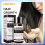 LANBENA Fast Powerful Hair Growth Essence Products Essential Oil Liquid Treatment Preventing Hair Loss Hair Care Andrea 20ml