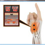 Magnetic Therapy Thumb/Wrist Glove