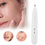 Professional Household Mole Removal Pen Dark Spots Freckle Remover Skin Beauty Instrument Professional Spots Removal Pen