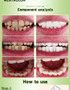 5ML Dental Teeth Whitening Tooth Cleaning Pen Tool