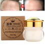 Whitening Cream Removal Melasma