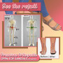 Premium Orthopedic Open Toe Sandals