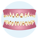 Amelogenesis Imperfecta icon