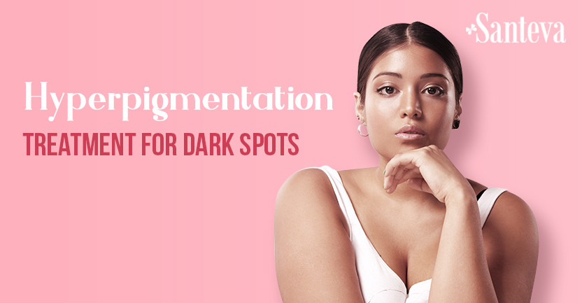 Hyperpigmentation treatment for dark spots?