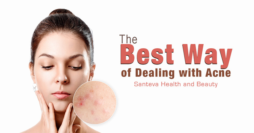 The Best Way of Dealing with Acne – Santeva Health and Beauty