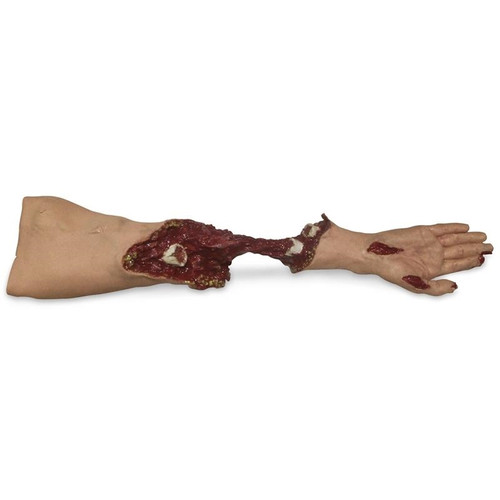 Nasco SMART STAT Xtreme Trauma Moulage Arm