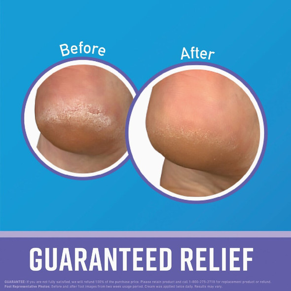 O'Keeffe's Healthy Feet 3 Oz. Night Treatment Lotion K3201502 768640