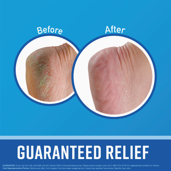 O'Keeffe's Healthy Feet 3.2 Oz. Jar Cream Lotion K0320005 750691