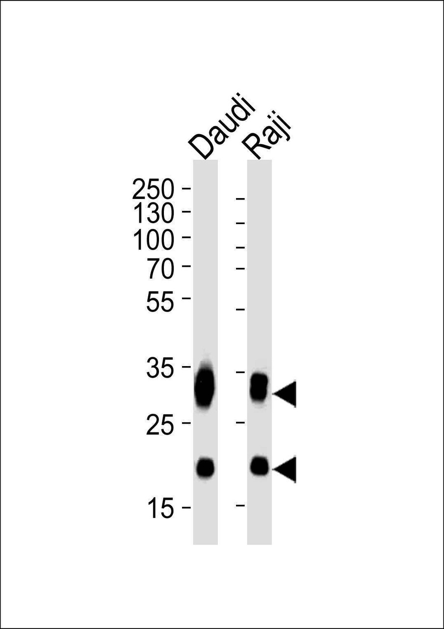 Multiplex Array Kit Anti-CD74 Antibody | RayBiotech