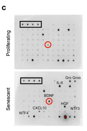 Figure adapted from Anerillas et al., Nature Communications, 2022.