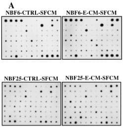 Figure adapted from Alshehri et al., Cells, 2024.