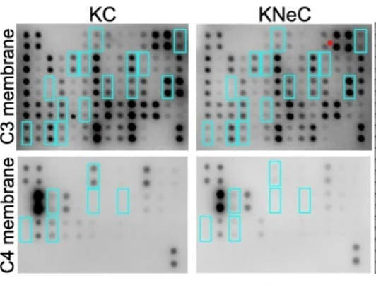 Figure adapted from Tsesmelis et al., Molecular Cancer, 2024.