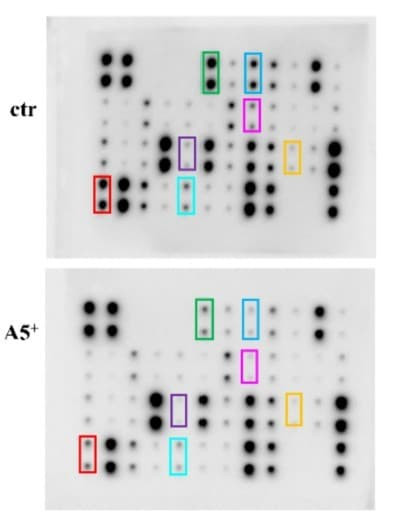Figure adapted from Pacifici et al., Cells, 2023. AAH-INF-1-2
