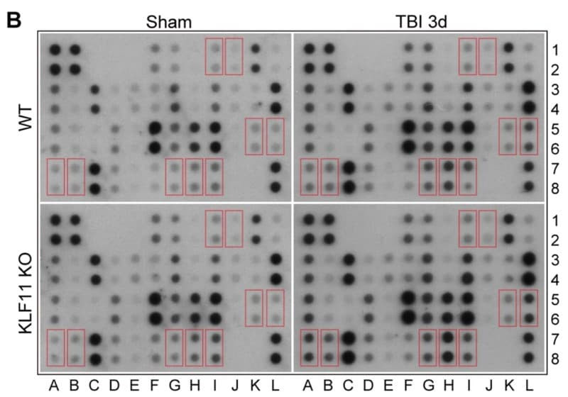 Figure adapted from Zhou et al., Journal of Neuroinflammation, 2022.