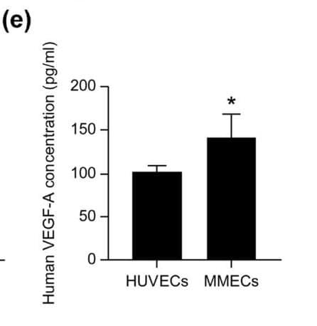 ELH-VEGF was used to measure VEGFA in endothelial cell supernatants from HUVECs and myeloma-associated endothelial cells (MMECs). Figure adapted from Sun et al., Scientific Reports, 2023.