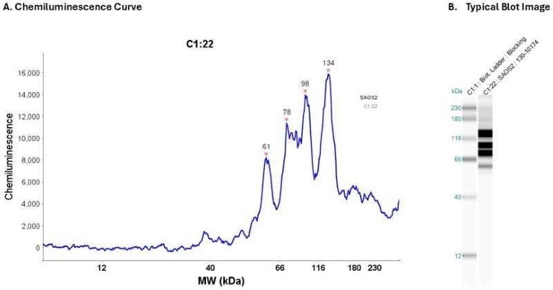 Cell Lysate: SAOS2 0.2 mg/ml | Secondary Ab: Mouse | Exposure: 5 sec | Expected MW (kDa): 55