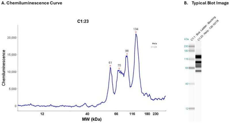 Cell Lysate: Hela 0.2 mg/ml | Secondary Ab: Mouse | Exposure: 5 sec | Expected MW (kDa): 55