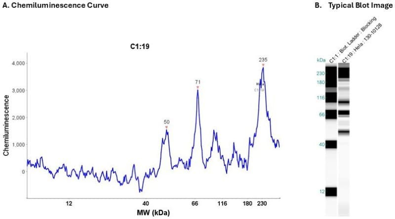 Cell Lysate: Hela 0.2 mg/ml | Secondary Ab: Rabbit | Exposure: 30 sec | Expected MW (kDa): 55