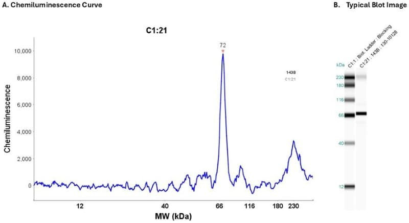 Cell Lysate: 143B 0.2 mg/ml | Secondary Ab: Rabbit | Exposure: 30 sec | Expected MW (kDa): 55