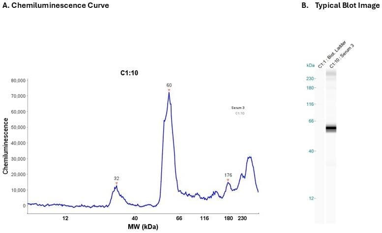 Human serum 20X | Secondary Ab: Mouse | Exposure: 5 sec | Expected MW (kDa): 45.3