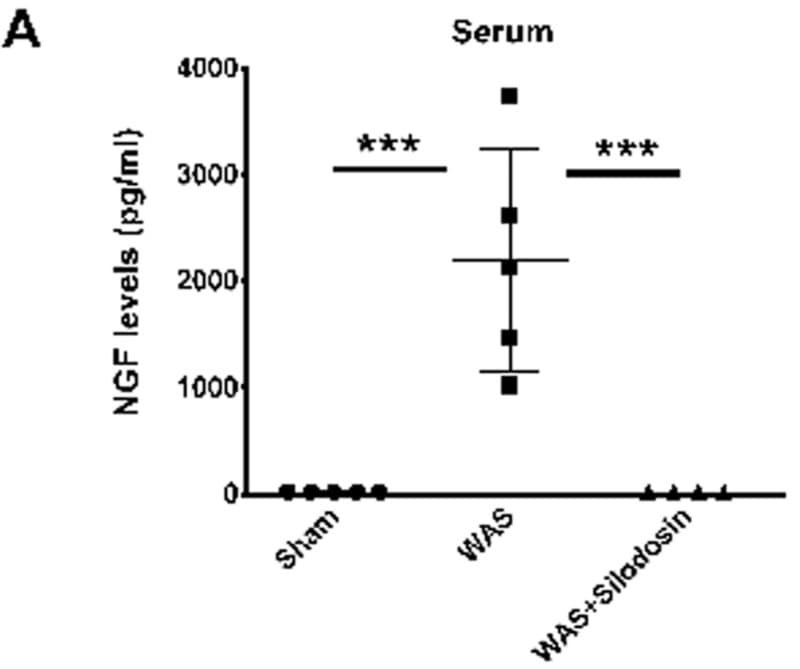 The Human β-NGF ELISA Kit (ELH-BNGF) was used to quantify NGF levels in serum and urine from rats exposed to Water Avoidance Stress (WAS). Figure adapted from Dias et al., Scientific Reports, 2019.