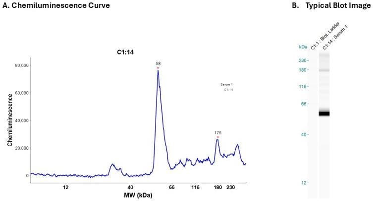 Human serum 20X | Secondary Ab: Mouse | Exposure: 5 sec | Expected MW (kDa): 45.3