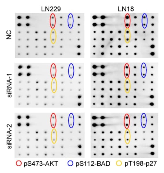 RayBiotech's AKT Pathway Phosphorylation Antibody Array was used to assess the effects of NLRP6 knockdown on PI3K/AKT signaling in glioblastoma cells. Figure adapted from Zhi et al., Nat Commun, 2023.